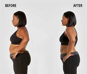 Slimvance Before and After