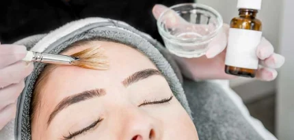 Why are Chemical Peels Still a Natural Complexion Care Essential?