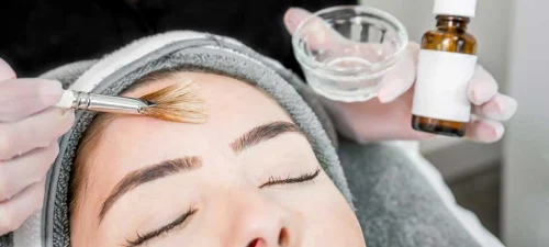 chemical peels