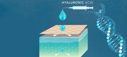 hyaluronic acid