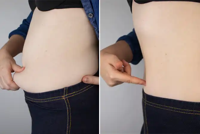 Avis des clients de KetoCharge